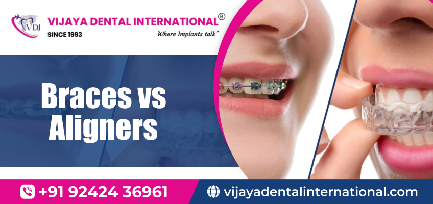 Best Aligners in Rajajinagar