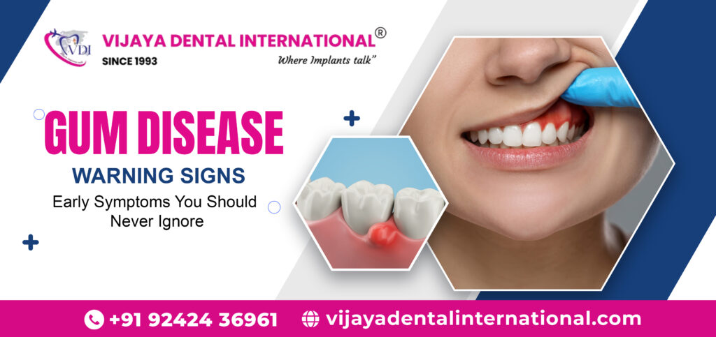 Laser Gum Treatment in Mathikere