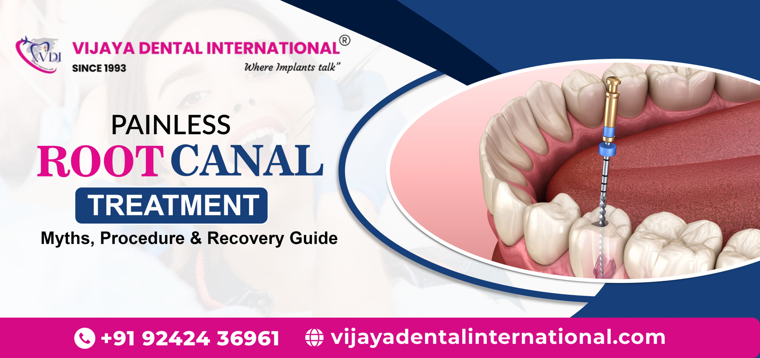 Best Root Canal Treatment in Bangalore