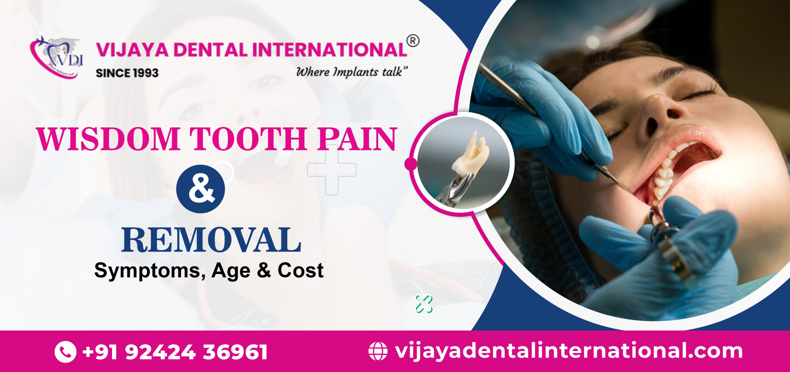 Wisdom tooth removal in Jayanagar